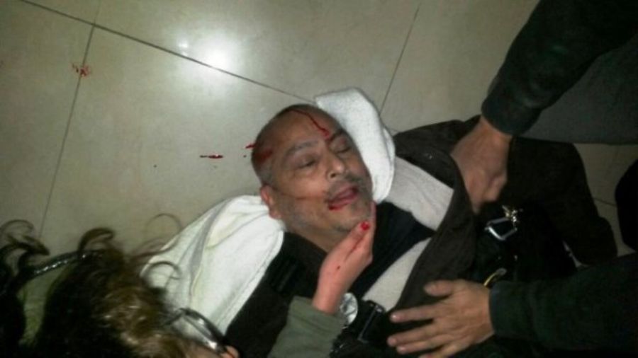 fotografo ate represión