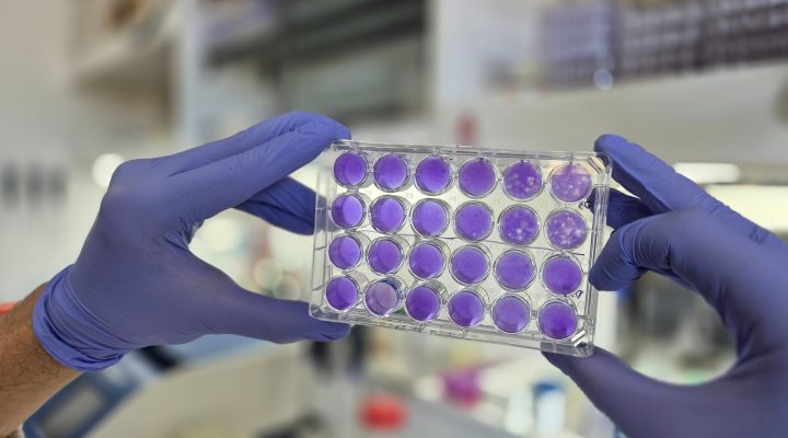 mecanismo común dengue zika fiebre amarilla CONICET